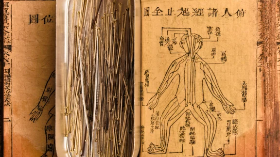 Traditional Chinese Medicine acupuncture chart and fine needles