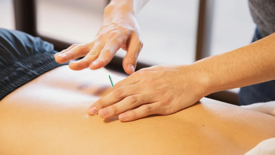 Acupuncture needle being placed in a patient's back