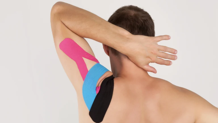 Kinesiology tape applied to a patient's shoulder for a sports injury